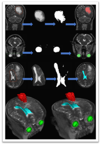 medical image processing phd